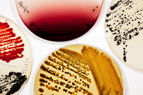 Four petri dishes are placed together, light shines under the dishes illuminating the bright yellow and red cultures. 
